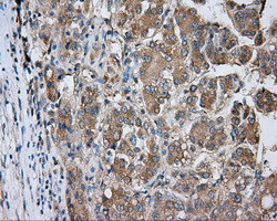 PRKAR2A Antibody in Immunohistochemistry (Paraffin) (IHC (P))