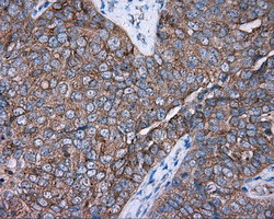 PRKAR2A Antibody in Immunohistochemistry (Paraffin) (IHC (P))