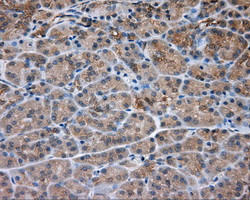 PRKAR2A Antibody in Immunohistochemistry (Paraffin) (IHC (P))