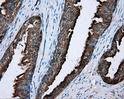 PRKAR2A Antibody in Immunohistochemistry (Paraffin) (IHC (P))