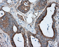 PRKAR2A Antibody in Immunohistochemistry (Paraffin) (IHC (P))