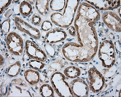 PRKAR2A Antibody in Immunohistochemistry (Paraffin) (IHC (P))