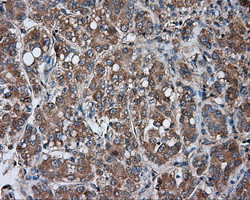 PRKAR2A Antibody in Immunohistochemistry (Paraffin) (IHC (P))