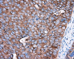 PRKAR2A Antibody in Immunohistochemistry (Paraffin) (IHC (P))