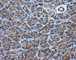 PRKAR2A Antibody in Immunohistochemistry (Paraffin) (IHC (P))