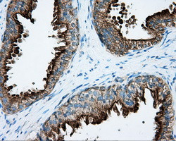 PRKAR2A Antibody in Immunohistochemistry (Paraffin) (IHC (P))