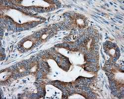 PRKAR2A Antibody in Immunohistochemistry (Paraffin) (IHC (P))