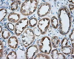 PRKAR2A Antibody in Immunohistochemistry (Paraffin) (IHC (P))