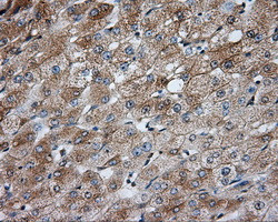 PRKAR2A Antibody in Immunohistochemistry (Paraffin) (IHC (P))