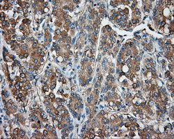 PRKAR2A Antibody in Immunohistochemistry (Paraffin) (IHC (P))