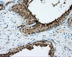 PRKAR2A Antibody in Immunohistochemistry (Paraffin) (IHC (P))