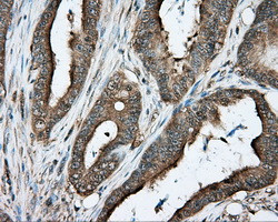 PRKAR2A Antibody in Immunohistochemistry (Paraffin) (IHC (P))