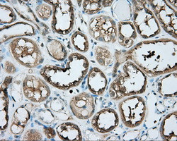 PRKAR2A Antibody in Immunohistochemistry (Paraffin) (IHC (P))