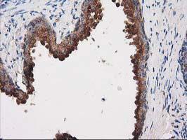 PRKAR2A Antibody in Immunohistochemistry (Paraffin) (IHC (P))