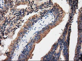 PRKAR2A Antibody in Immunohistochemistry (Paraffin) (IHC (P))