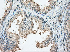 PRKAR2A Antibody in Immunohistochemistry (Paraffin) (IHC (P))