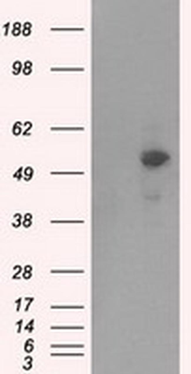 PRKAR2A Antibody in Western Blot (WB)