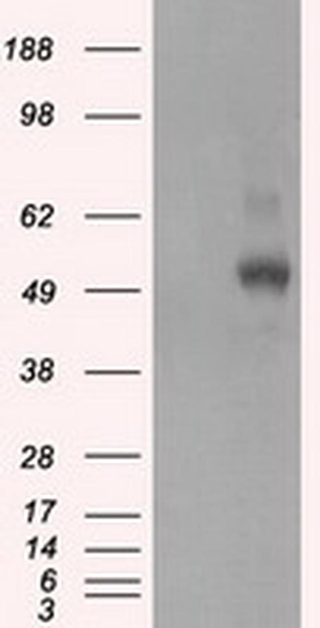 PRKAR2A Antibody in Western Blot (WB)