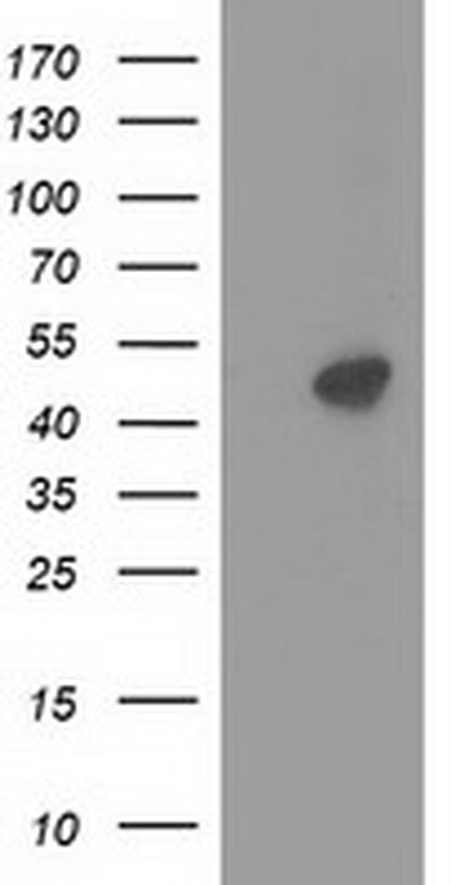 PRKAR2A Antibody in Western Blot (WB)