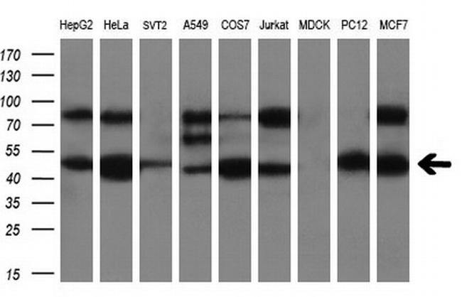 PRKAR2A Antibody in Western Blot (WB)