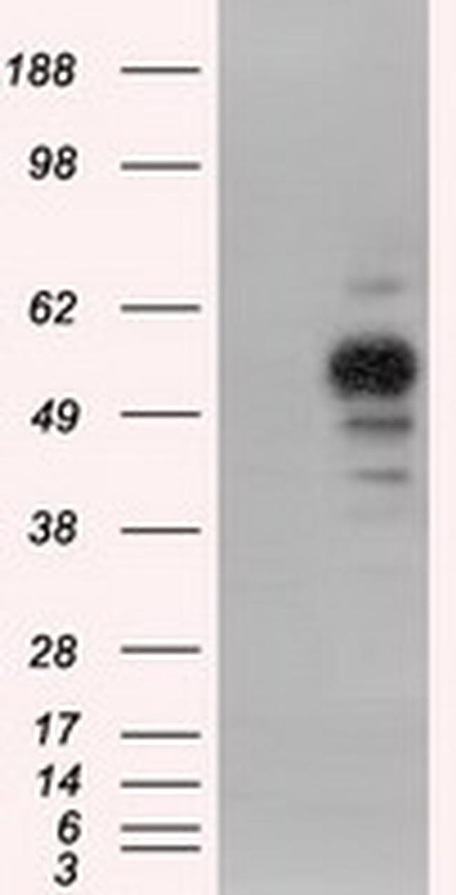 PRKAR2A Antibody in Western Blot (WB)