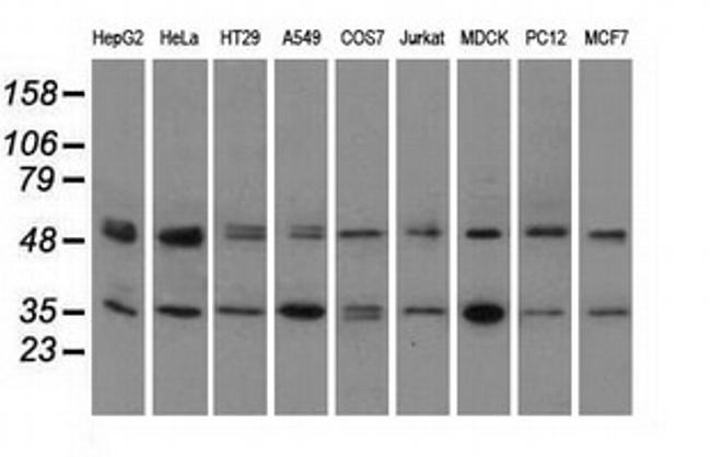PRKAR2A Antibody in Western Blot (WB)