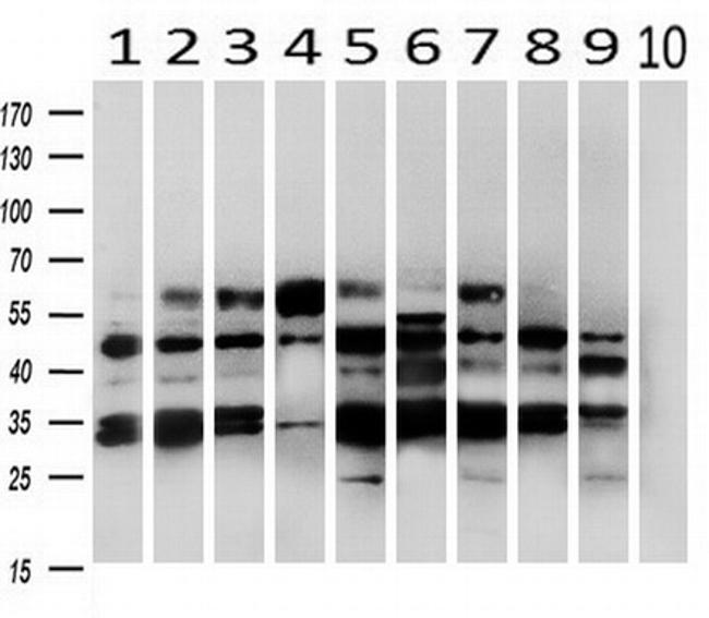 PRKAR2A Antibody in Western Blot (WB)