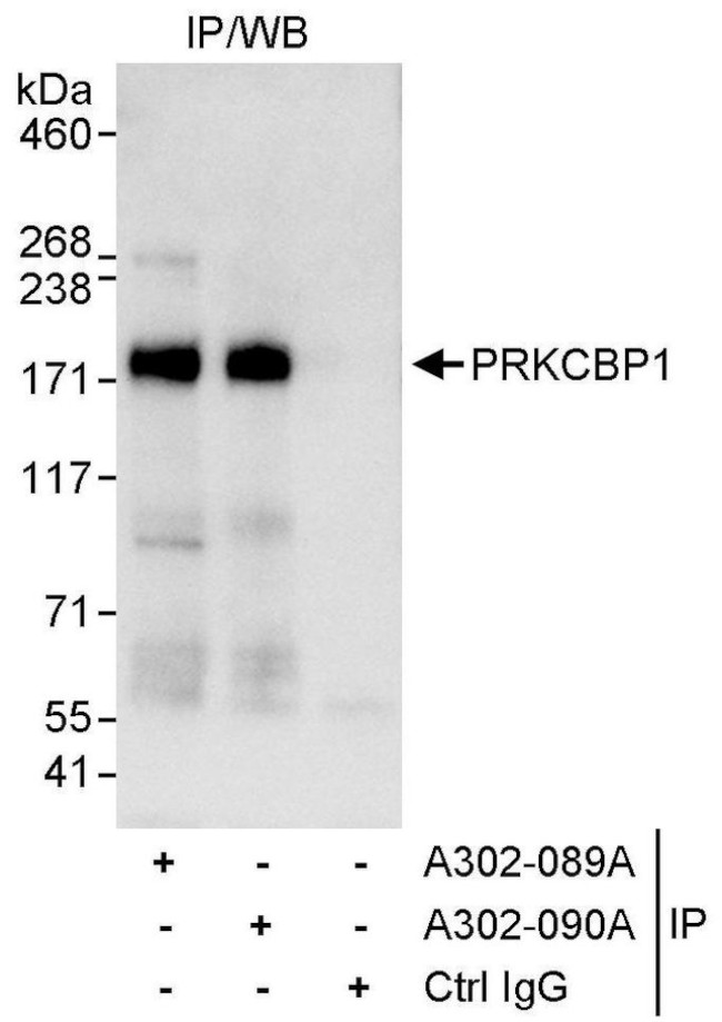 PRKCBP1 Antibody in Immunoprecipitation (IP)