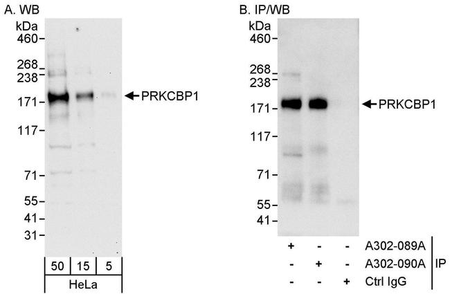 PRKCBP1 Antibody in Western Blot (WB)