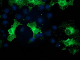 PRKCE Antibody in Immunocytochemistry (ICC/IF)