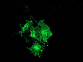 PRKCE Antibody in Immunocytochemistry (ICC/IF)