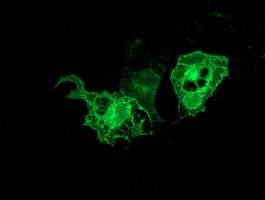 PRKCE Antibody in Immunocytochemistry (ICC/IF)