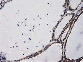 PRKCE Antibody in Immunohistochemistry (Paraffin) (IHC (P))