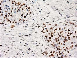 PRKCE Antibody in Immunohistochemistry (Paraffin) (IHC (P))