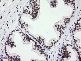 PRKCE Antibody in Immunohistochemistry (Paraffin) (IHC (P))