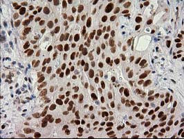 PRKCE Antibody in Immunohistochemistry (Paraffin) (IHC (P))