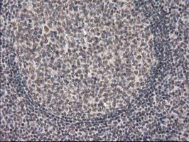 PRKCE Antibody in Immunohistochemistry (Paraffin) (IHC (P))