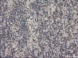 PRKCE Antibody in Immunohistochemistry (Paraffin) (IHC (P))