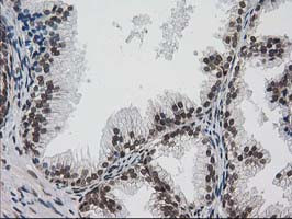 PRKCE Antibody in Immunohistochemistry (Paraffin) (IHC (P))