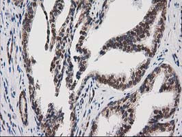 PRKCE Antibody in Immunohistochemistry (Paraffin) (IHC (P))