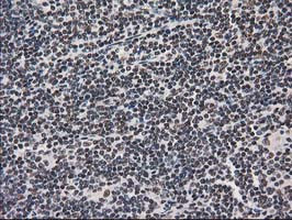 PRKCE Antibody in Immunohistochemistry (Paraffin) (IHC (P))