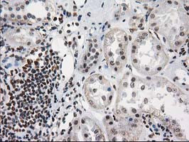 PRKCE Antibody in Immunohistochemistry (Paraffin) (IHC (P))