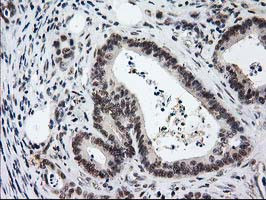 PRKCE Antibody in Immunohistochemistry (Paraffin) (IHC (P))