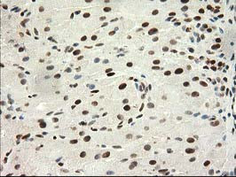 PRKCE Antibody in Immunohistochemistry (Paraffin) (IHC (P))