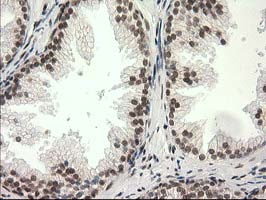 PRKCE Antibody in Immunohistochemistry (Paraffin) (IHC (P))