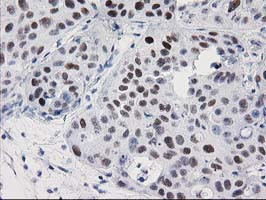 PRKCE Antibody in Immunohistochemistry (Paraffin) (IHC (P))