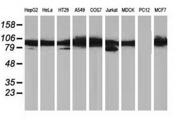 PRKCE Antibody in Western Blot (WB)