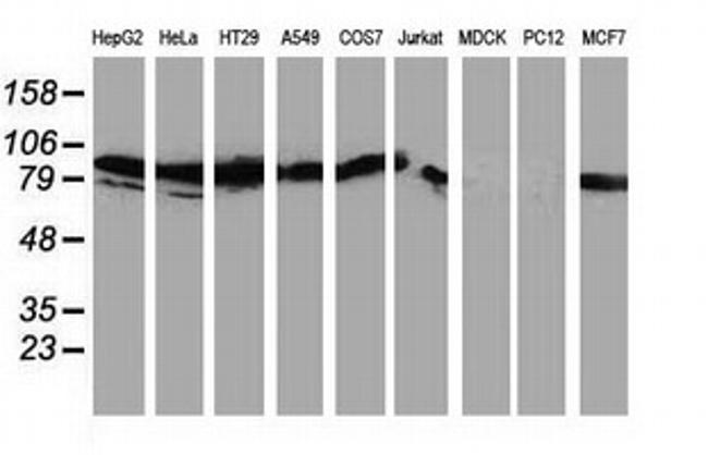 PRKCE Antibody in Western Blot (WB)