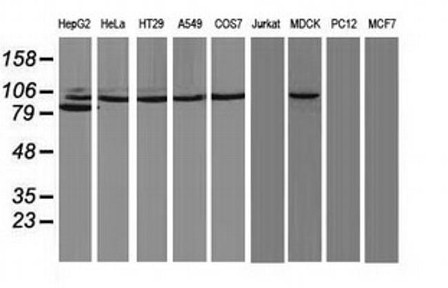 PRKCE Antibody in Western Blot (WB)