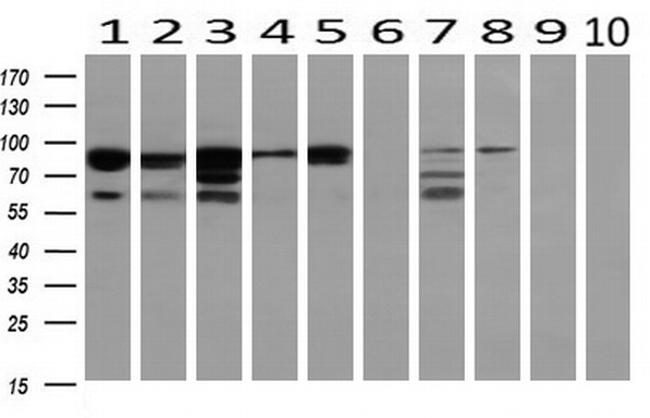 PRKCE Antibody in Western Blot (WB)